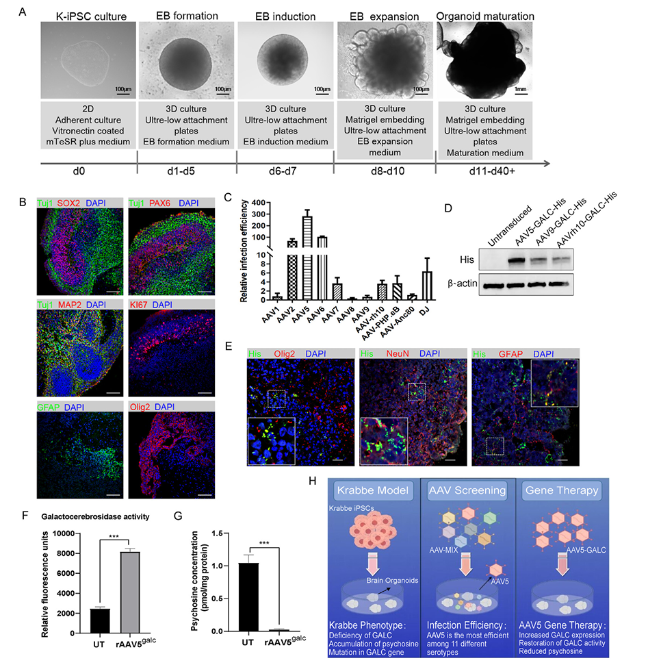 图4 建立来源于krabbe ipscs的脑类器官体，并鉴定用于基因治疗的aav血清型