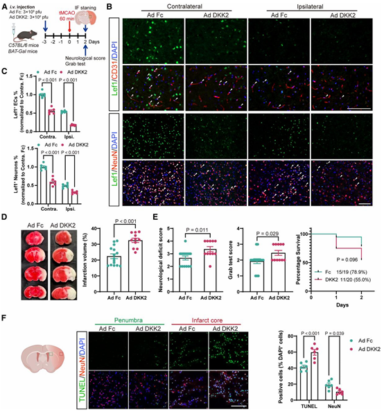 图2 神经元 dkk2 双向操控对 bbb 稳定性与卒中结局的因果影响