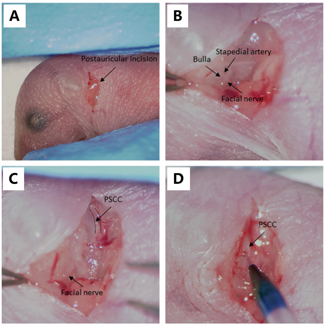 新生鼠后半规管（pscc）注射