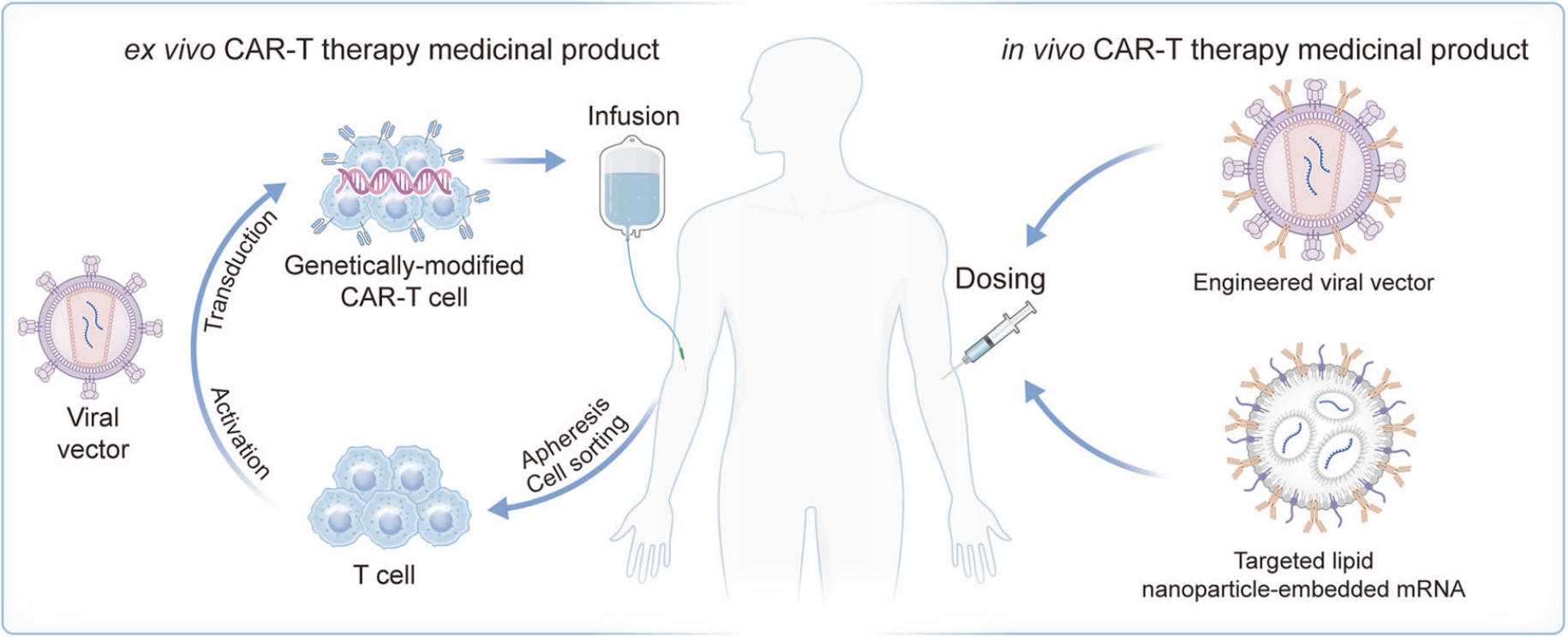 Ex vivo 与 in vivo CAR T 细胞疗法的生产流程比较示意图