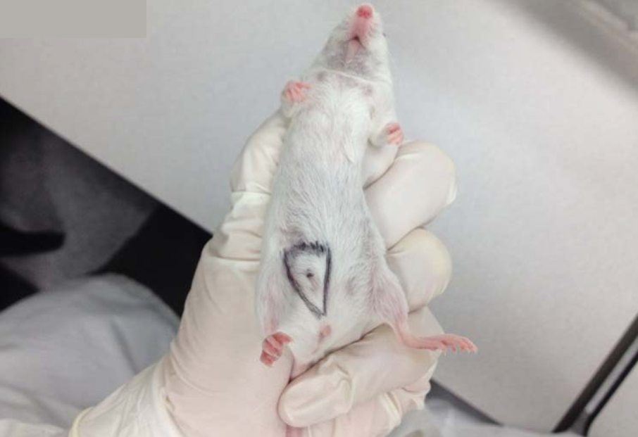 腹腔注射