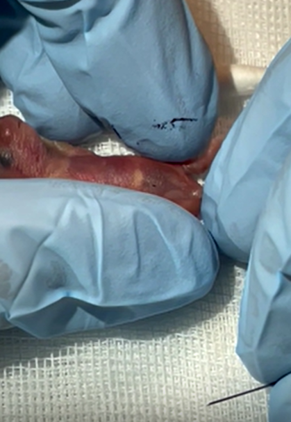腹腔注射2