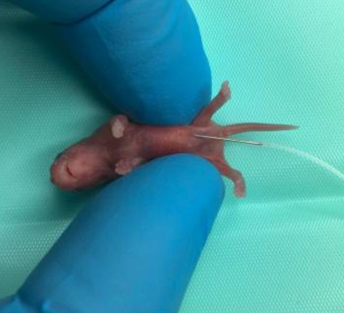 腹腔注射4